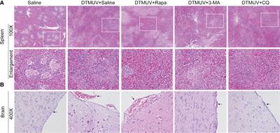 Corrigendum: Autophagy Is a Potential Therapeutic Target Against Duck Tembusu Virus Infection in Vivo